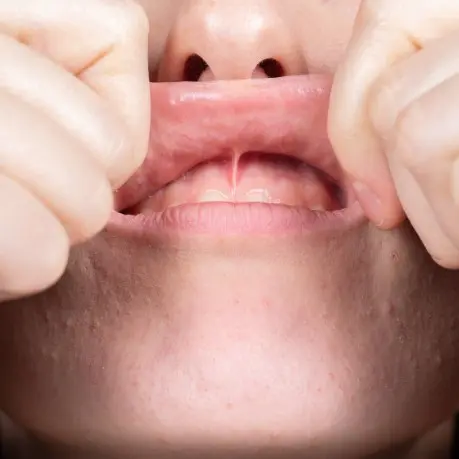 A person with their mouth open and hands on the lips.